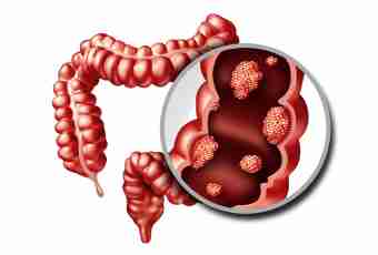 Problems with depletion of intestines at children: solutions