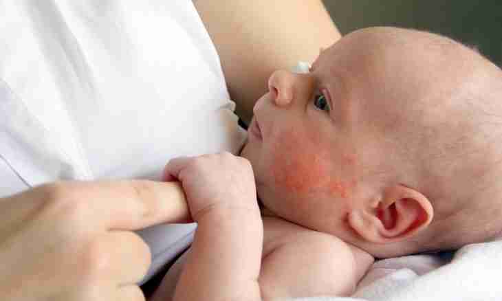 How to treat an allergy of newborns
