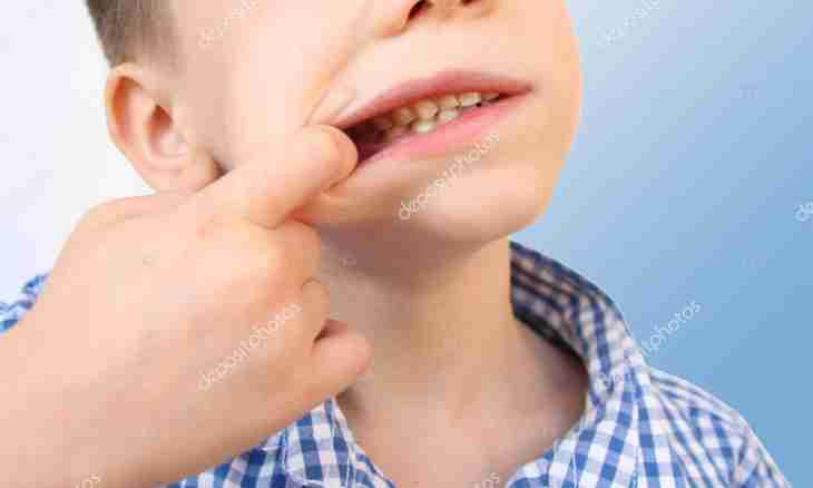 Whether the child needs to treat milk teeth up to 5 years