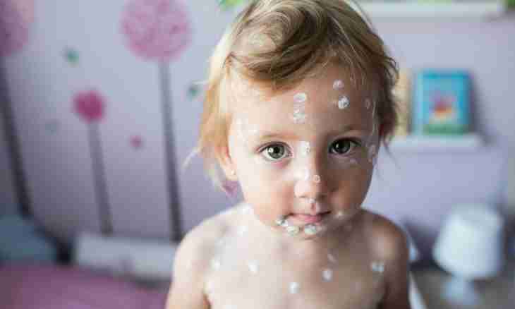 How many the child has chickenpox