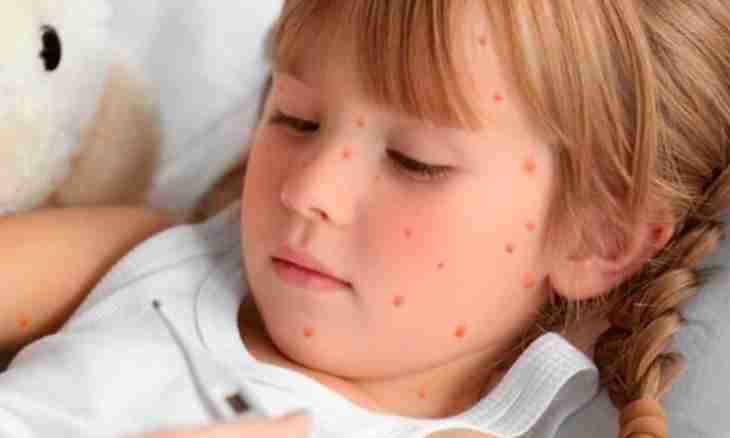 How to distinguish and than to treat chickenpox
