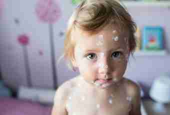 How not to be infected with chickenpox by the child