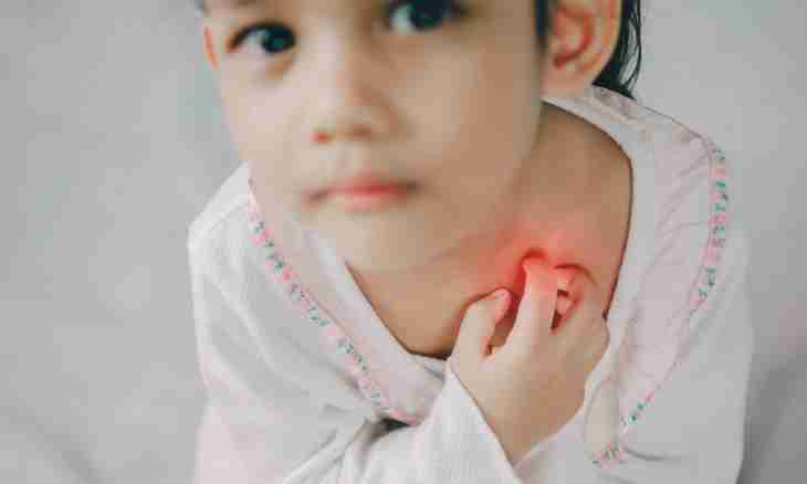 How to treat rashes at children
