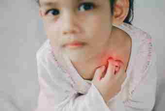 How to treat rashes at children