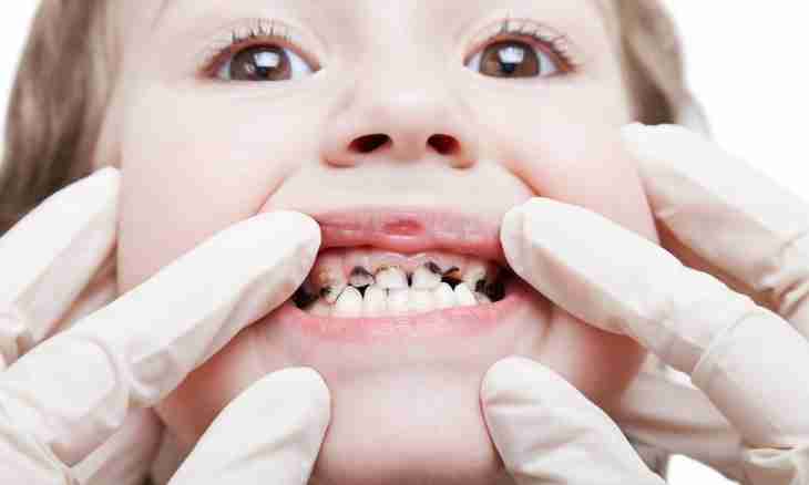 How to treat caries at the small child