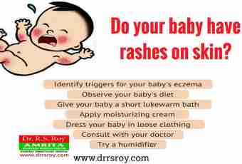 Child's skin: rash, spots, diathesis: how to distinguish and treat