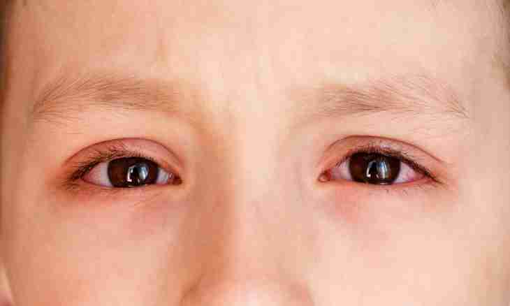 Conjunctivitis at children: how to treat house means