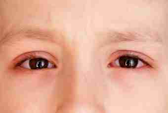 Conjunctivitis at children: how to treat house means
