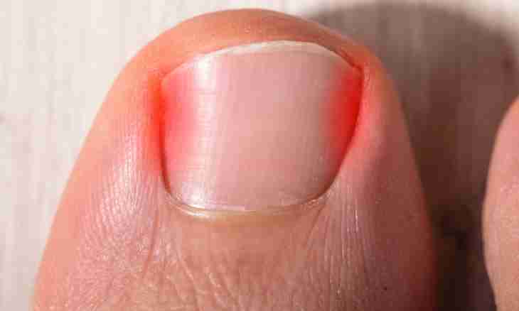 How to treat a nail fungus at children