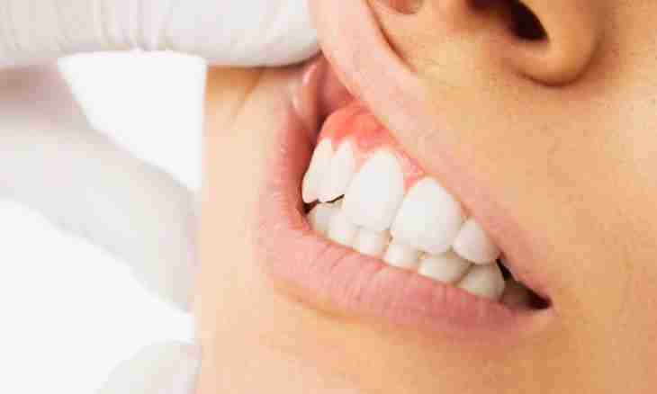 How to do massage of gums