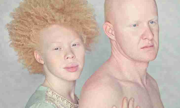 Why people albinos are born