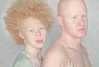 Why people albinos are born