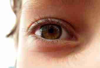 Why eyes brown