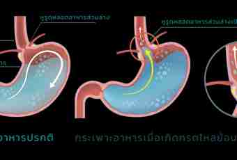 What enzymes are in gastric juice
