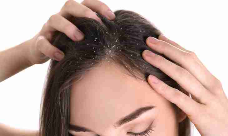How to get rid of dandruff at a cat